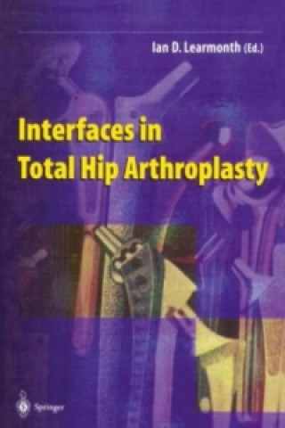 Kniha Interfaces in Total Hip Arthroplasty Ian D. Learmonth