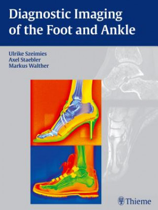 Kniha Diagnostic Imaging of the Foot and Ankle Ulrike Szeimies