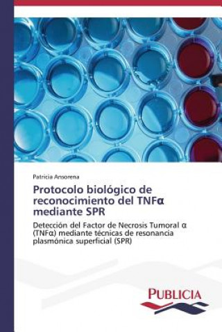 Carte Protocolo biologico de reconocimiento del TNF&#945; mediante SPR Patricia Ansorena