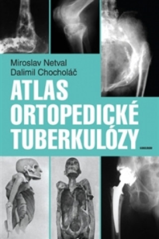Carte Atlas ortopedické tuberkulózy Miroslav Netval