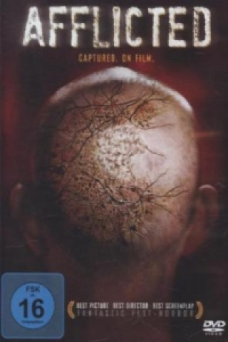 Video Afflicted, 1 DVD Greg Ng
