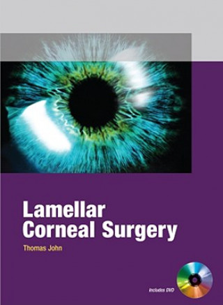 Knjiga Lamellar Corneal Surgery Thomas John