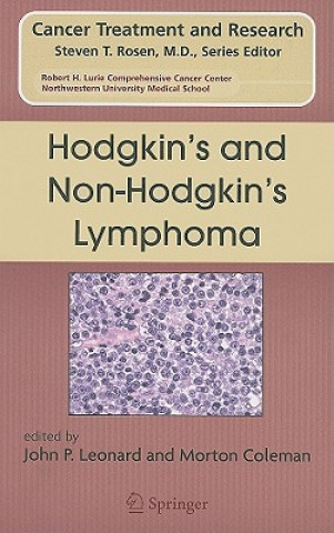 Knjiga Hodgkin's and Non-Hodgkin's Lymphoma Morton Coleman