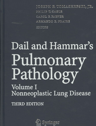 Kniha Dail and Hammar's Pulmonary Pathology Joseph F. Tomashefski