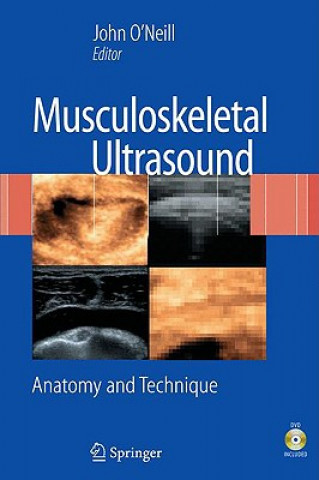 Kniha Musculoskeletal Ultrasound John O'Neill