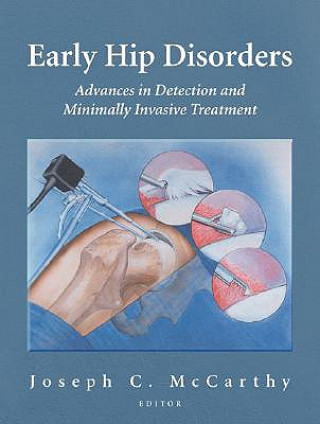 Kniha Early Hip Disorders Joseph C. McCarthy