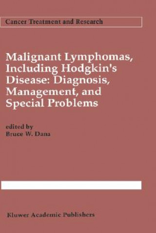 Kniha Malignant lymphomas, including Hodgkin's disease: Diagnosis, management, and special problems Bruce W. Dana