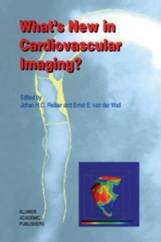 Książka What's New in Cardiovascular Imaging? Johan H. C. Reiber