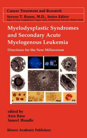 Könyv Myelodysplastic Syndromes & Secondary Acute Myelogenous Leukemia Suneel D. Mundle