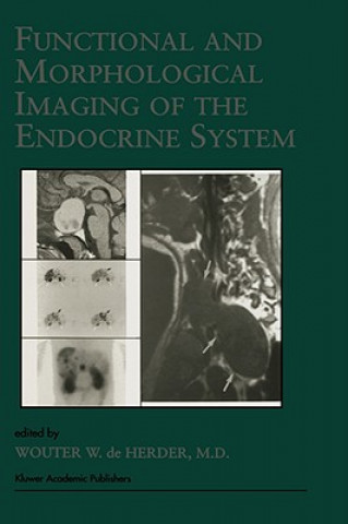 Carte Functional and Morphological Imaging of the Endocrine System W. W. De Herder