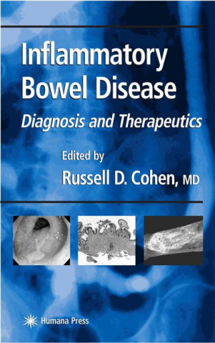 Book Inflammatory Bowel Disease Amber Schroader