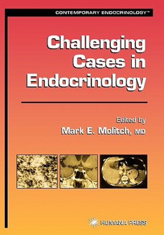 Buch Challenging Cases in Endocrinology Mark E. Molitch