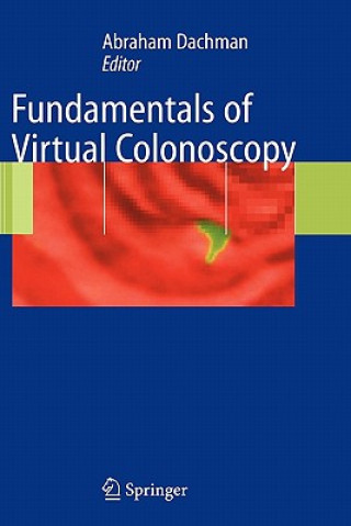Carte Fundamentals of Virtual Colonoscopy Abraham H. Dachman