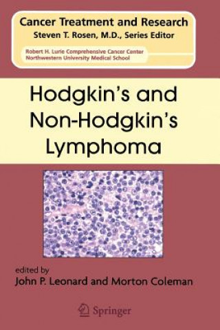 Kniha Hodgkin's and Non-Hodgkin's Lymphoma Morton Coleman