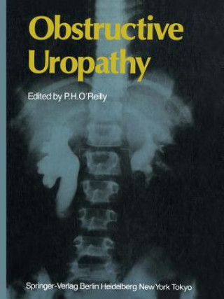 Książka Obstructive Uropathy Patrick H. O'Reilly