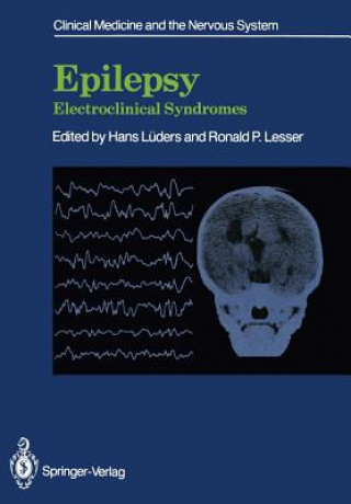 Knjiga Epilepsy Ronald P. Lesser