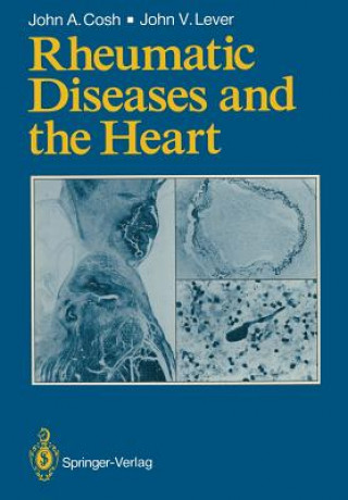 Kniha Rheumatic Diseases and the Heart John A. Cosh