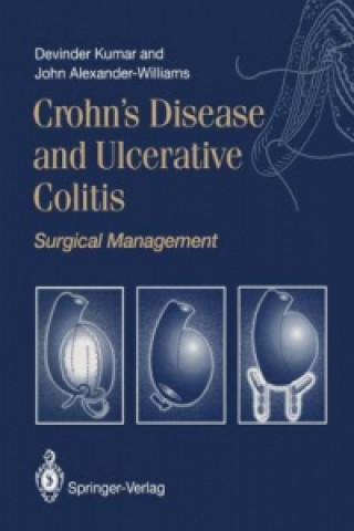 Kniha Crohn's Disease and Ulcerative Colitis Devinder Kumar