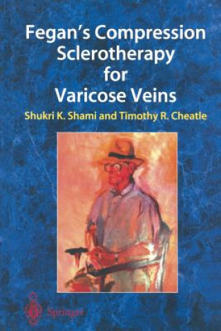 Könyv Fegan's Compression Sclerotherapy for Varicose Veins Timothy R. Cheatle