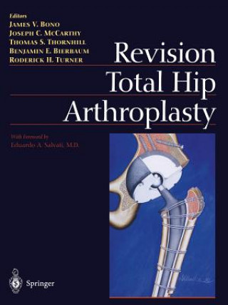 Kniha Revision Total Hip Arthroplasty Benjamin E. Bierbaum