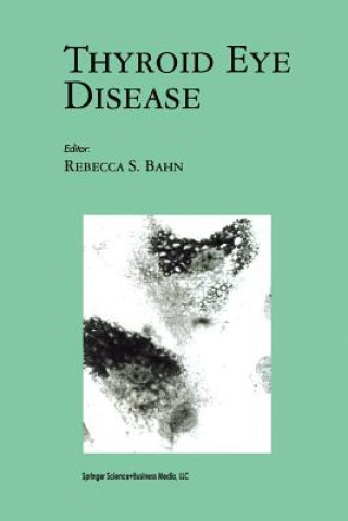Könyv Thyroid Eye Disease Rebecca S. Bahn