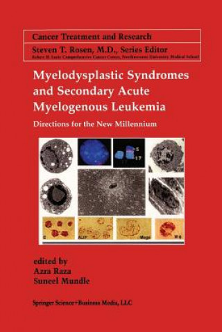 Книга Myelodysplastic Syndromes & Secondary Acute Myelogenous Leukemia Suneel D. Mundle
