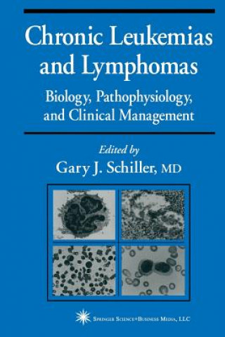 Kniha Chronic Leukemias and Lymphomas Gary J. Schiller
