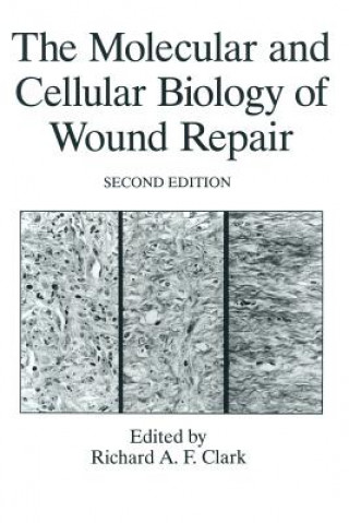 Book Molecular and Cellular Biology of Wound Repair R. A. F. Clark