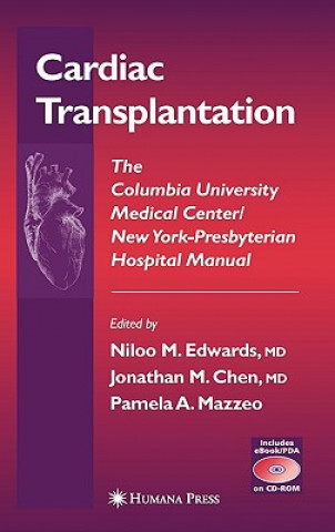 Carte Cardiac Transplantation Niloo M. Edwards