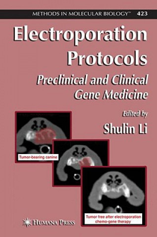 Knjiga Electroporation Protocols Shulin Li