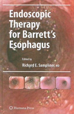 Kniha Endoscopic Therapy for Barrett's Esophagus Richard E. Sampliner