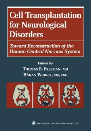 Könyv Cell Transplantation for Neurological Disorders Thomas B. Freeman