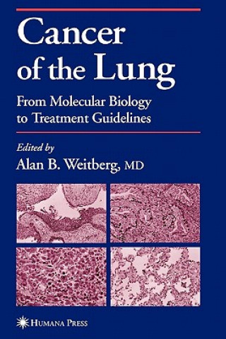 Könyv Cancer of the Lung Alan Weitberg