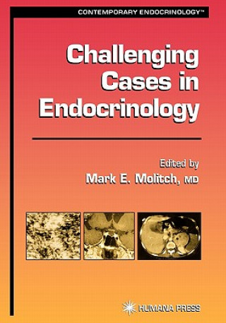 Carte Challenging Cases in Endocrinology Mark E. Molitch