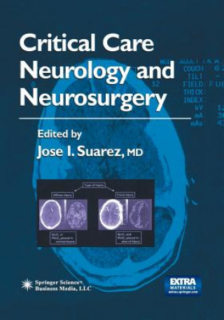 Kniha Critical Care Neurology and Neurosurgery Jose I. Suarez