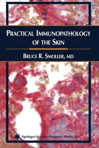 Kniha Practical Immunopathology of the Skin Bruce R. Smoller