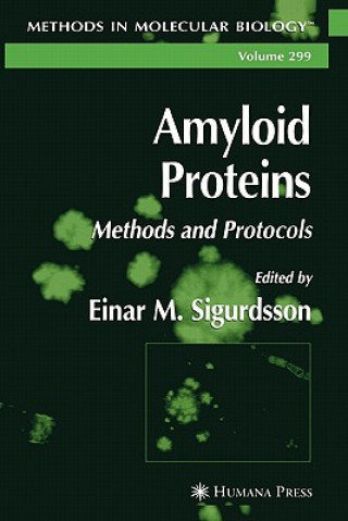 Carte Amyloid Proteins Einar M. Sigurdsson