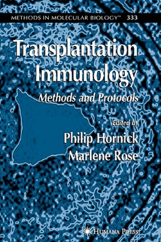 Книга Transplantation Immunology Philip Hornick