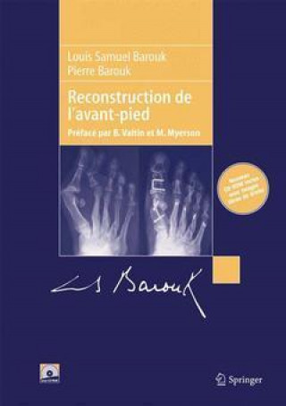 Könyv Reconstruction de l'avant-pied Louis-Samuel Barouk