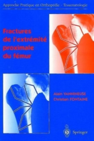 Livre Fractures de l'extrémité proximale du fémur Alain Vannineuse