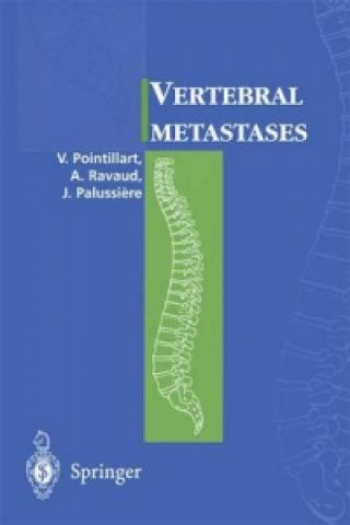 Book Vertebral metastases Vincent Pointillard