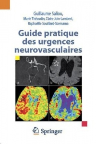 Kniha Guide pratique des urgences neurovasculaires Marie Théaudin