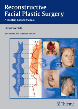 Kniha Reconstructive Facial Plastic Surgery Hilko Weerda