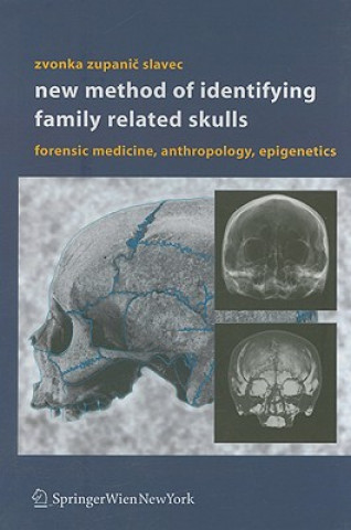 Carte New Method of Identifying Family Related Skulls Zvonka Zupanic Slavec