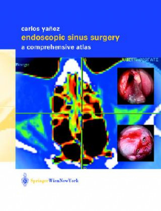 Buch Endoscopic Sinus Surgery C. Yanez