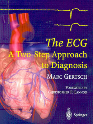 Kniha ECG Marc Gertsch