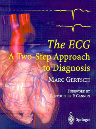 Buch ECG Marc Gertsch