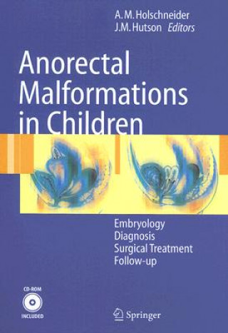 Book Anorectal Malformations in Children Alexander M. Holschneider