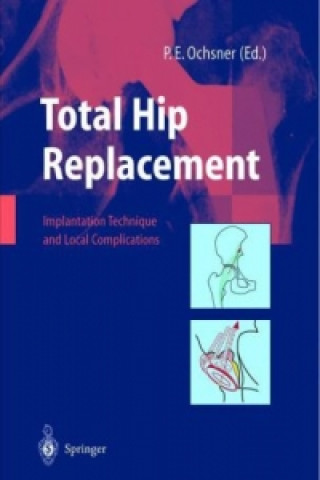 Książka Total Hip Replacement P. E. Ochsner