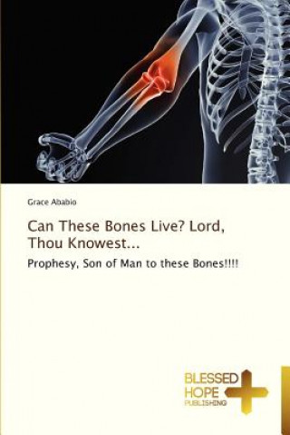 Carte Can These Bones Live? Lord, Thou Knowest... Grace Ababio